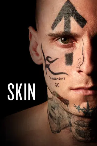 Skin