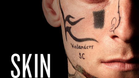 Skin
