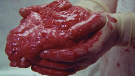 Brain of Blood