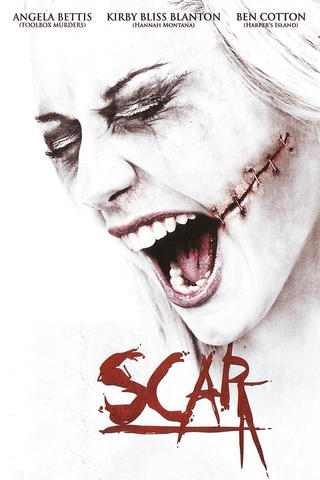 Scar 3D