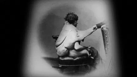 Through the Weeping Glass: On the Consolations of Life Everlasting (Limbos & Afterbreezes in the Mütter Museum)