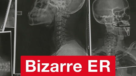 Bizarre ER