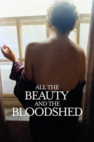 Nan Goldin: Fotografens kamp mot läkemedelsjätten