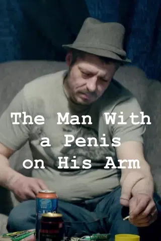 The Man with a Penis on His Arm