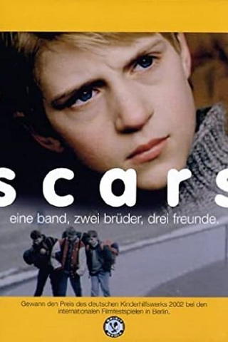 Scars