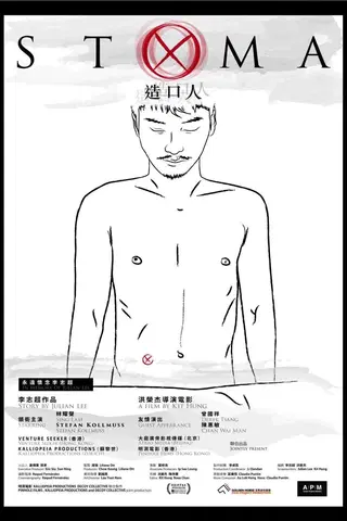 Stoma