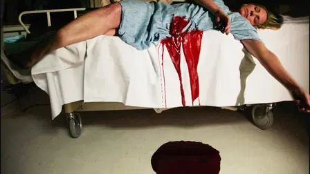 Needlestick