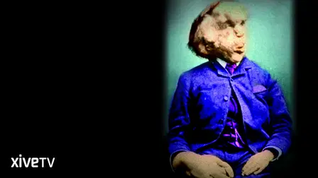 The Curse of the Elephant Man