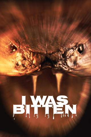 I Was Bitten