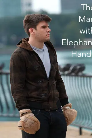 The Man With Elephant Hands