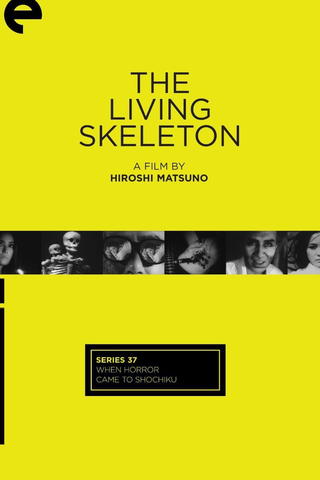 Living Skeleton